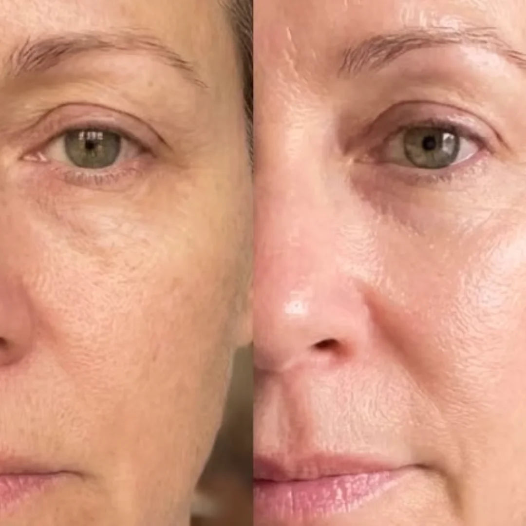 Antes e depois 1