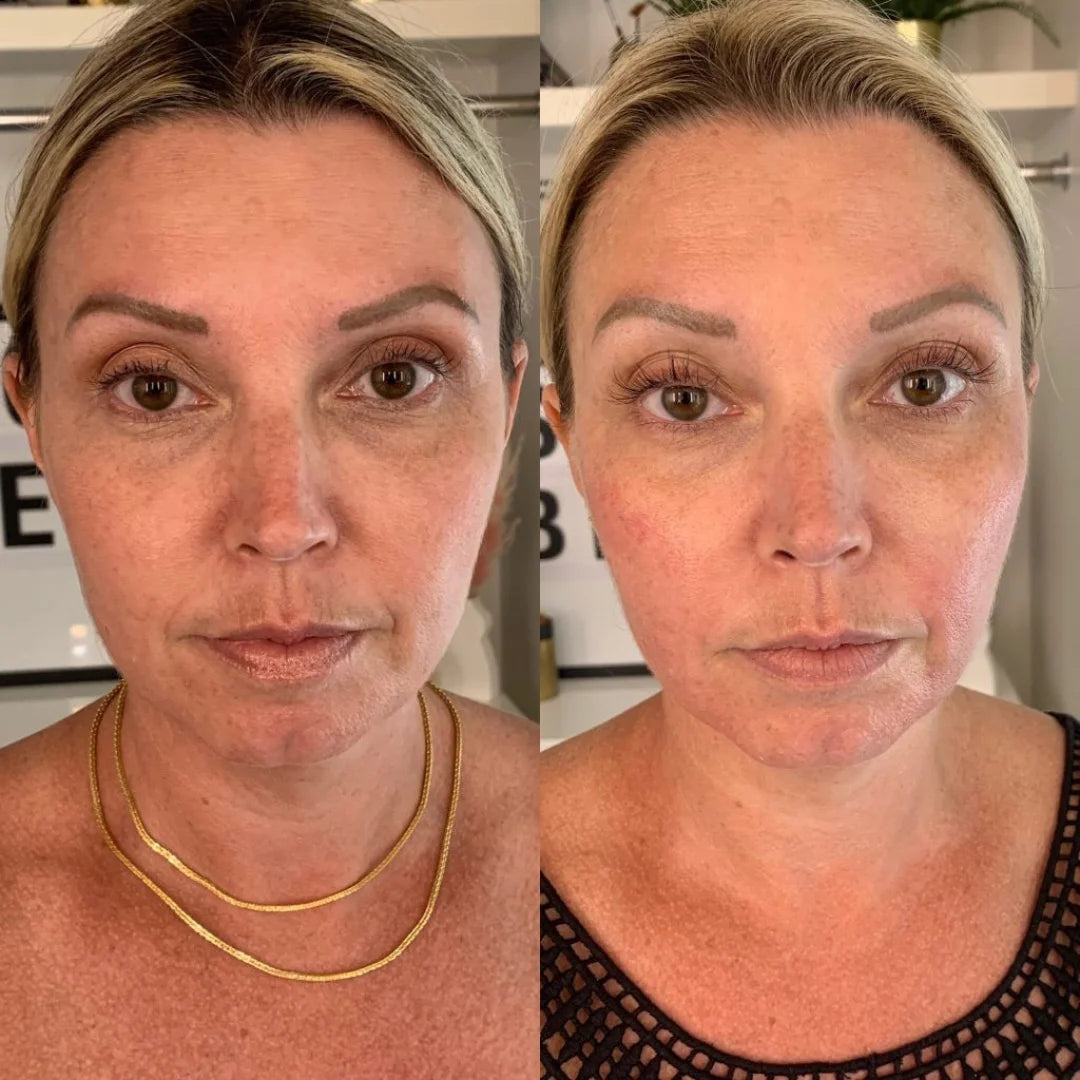 Antes e depois 5